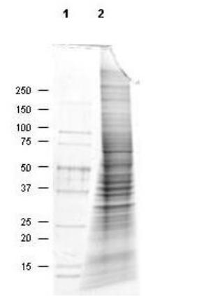 Coomassie stained SDS-PAGE of 30 μg of MDA-MB-435S Whole Cell Lysate resolved using a 4-20% gradient gel under reducing conditions (lane 2). Molecular weight standards are shown in lane 1.